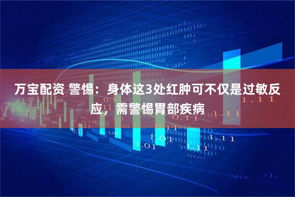 万宝配资 警惕：身体这3处红肿可不仅是过敏反应，需警惕胃部疾病